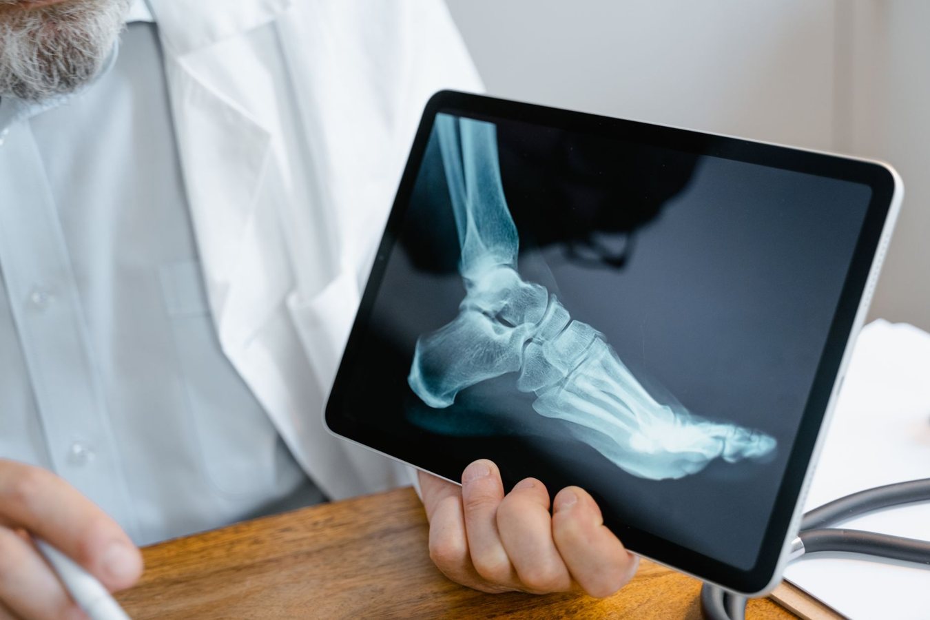 Anatomie du pied : os, muscles, tendons et douleurs fréquentes